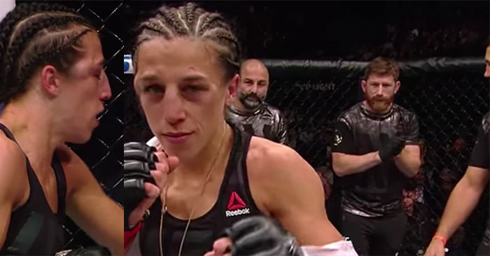 Battle Wounds — Joanna Champion’s Face One Day After Her Five Round War At MSG