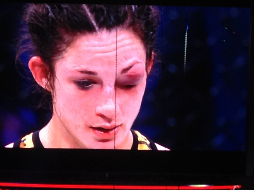Brooke Mayo Looses Fight to Veta Artega by Doctor Stoppage at Bellator
